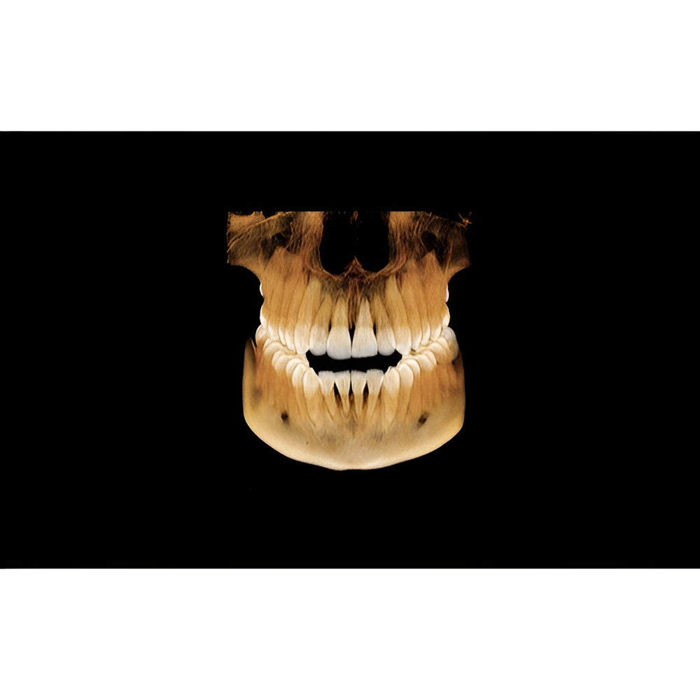 Vatech PaX-i Green CT Pan + CBCT (12x9 FOV)