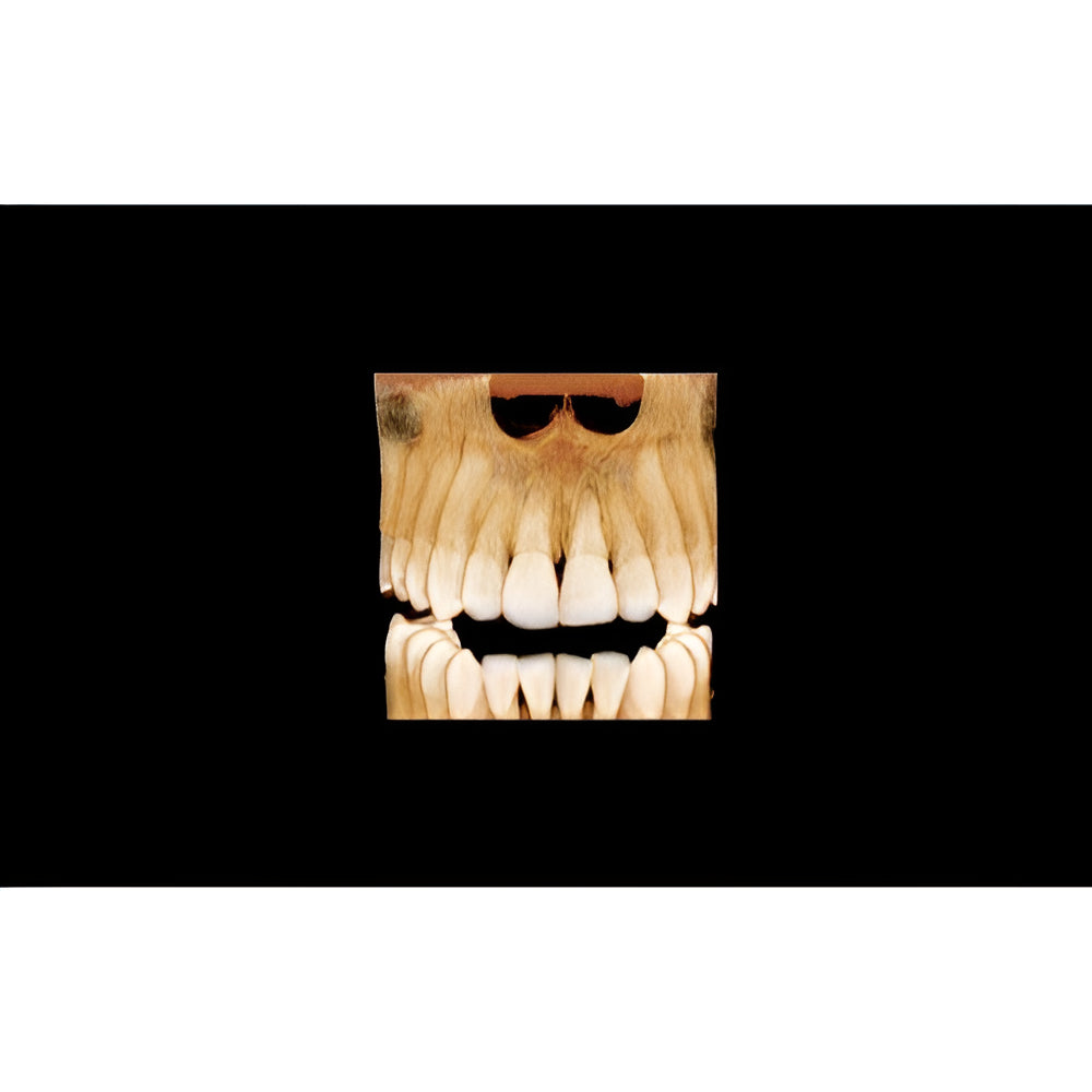 Vatech PaX-i Green CT Pan + CBCT (12x9 FOV)
