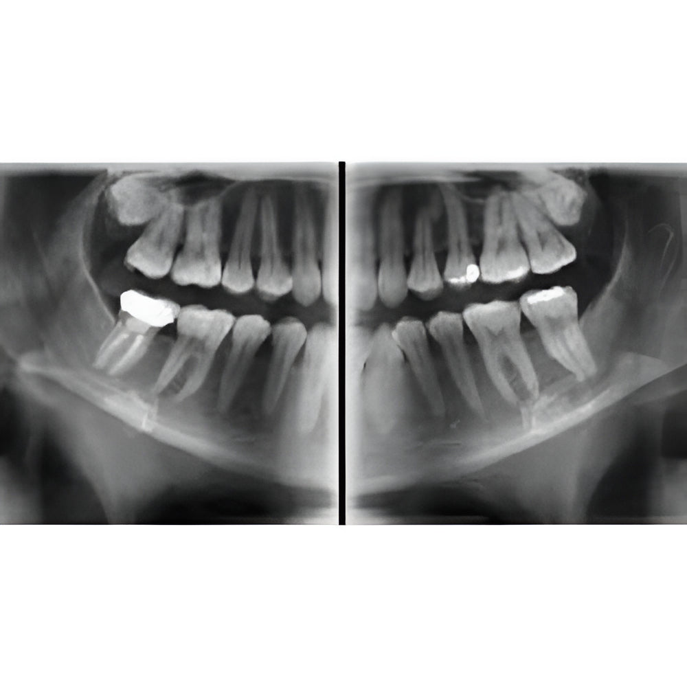 Vatech PaX-i Green CT Pan + CBCT (12x9 FOV)