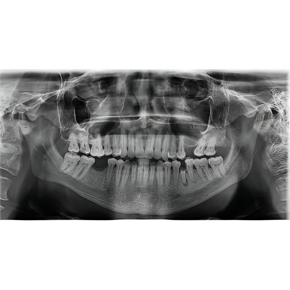 2021 Vatech PaX-i Smart Plus Pan + CBCT (10x8.5 FOV)