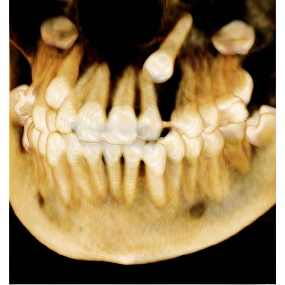 i-CAT FLX V17 Pan + CBCT (23x17 FOV)