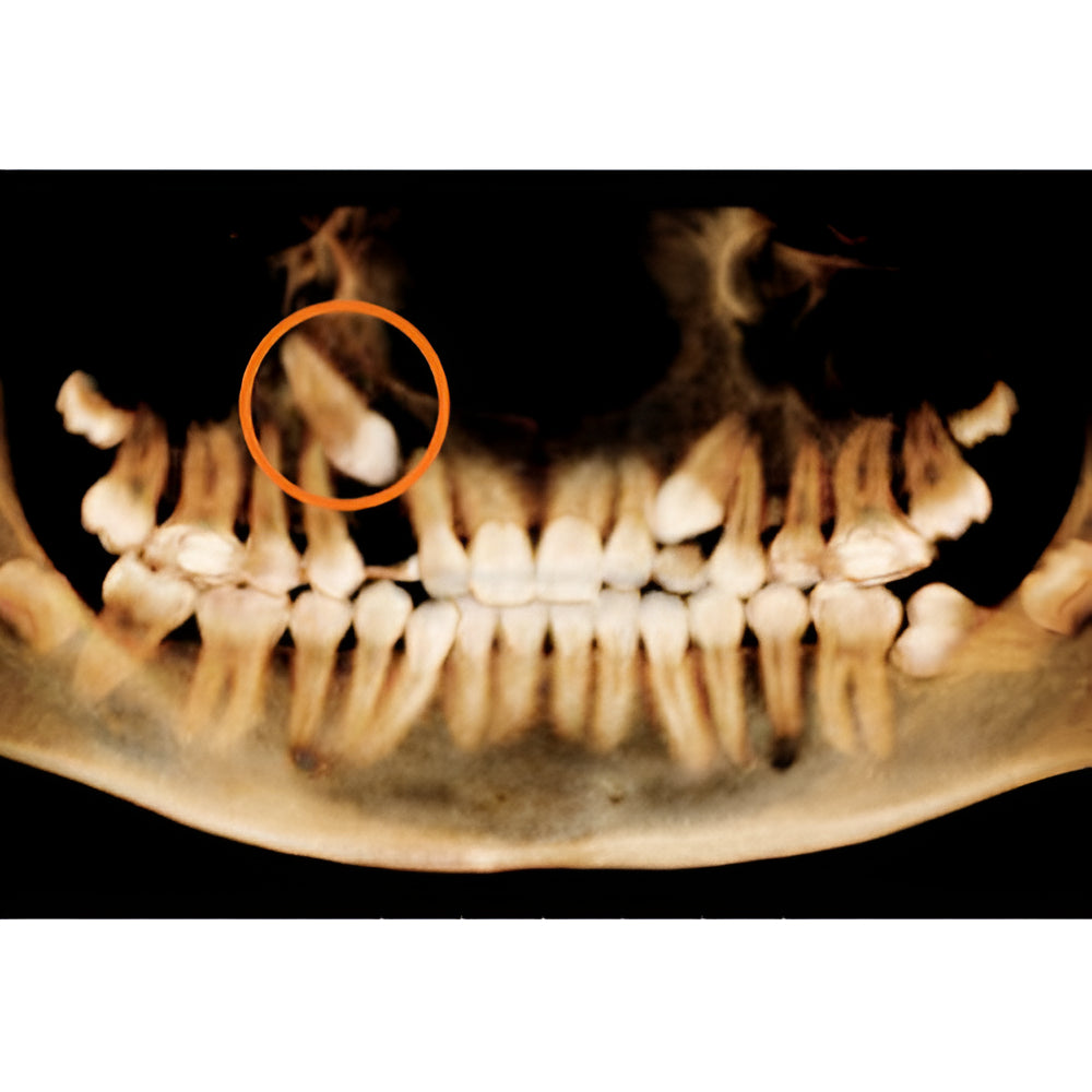 i-CAT FLX V17 Pan + CBCT (23x17 FOV)