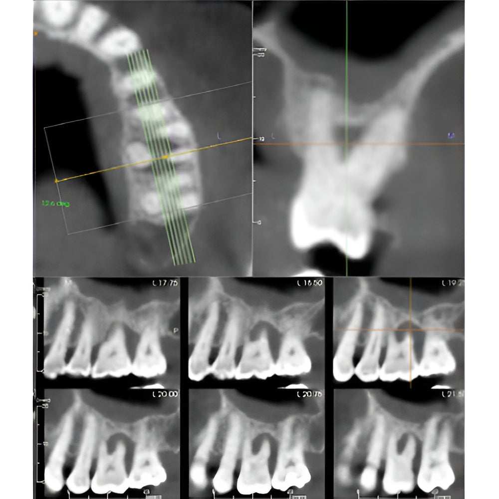 i-CAT FLX V17 Pan + CBCT (23x17 FOV)