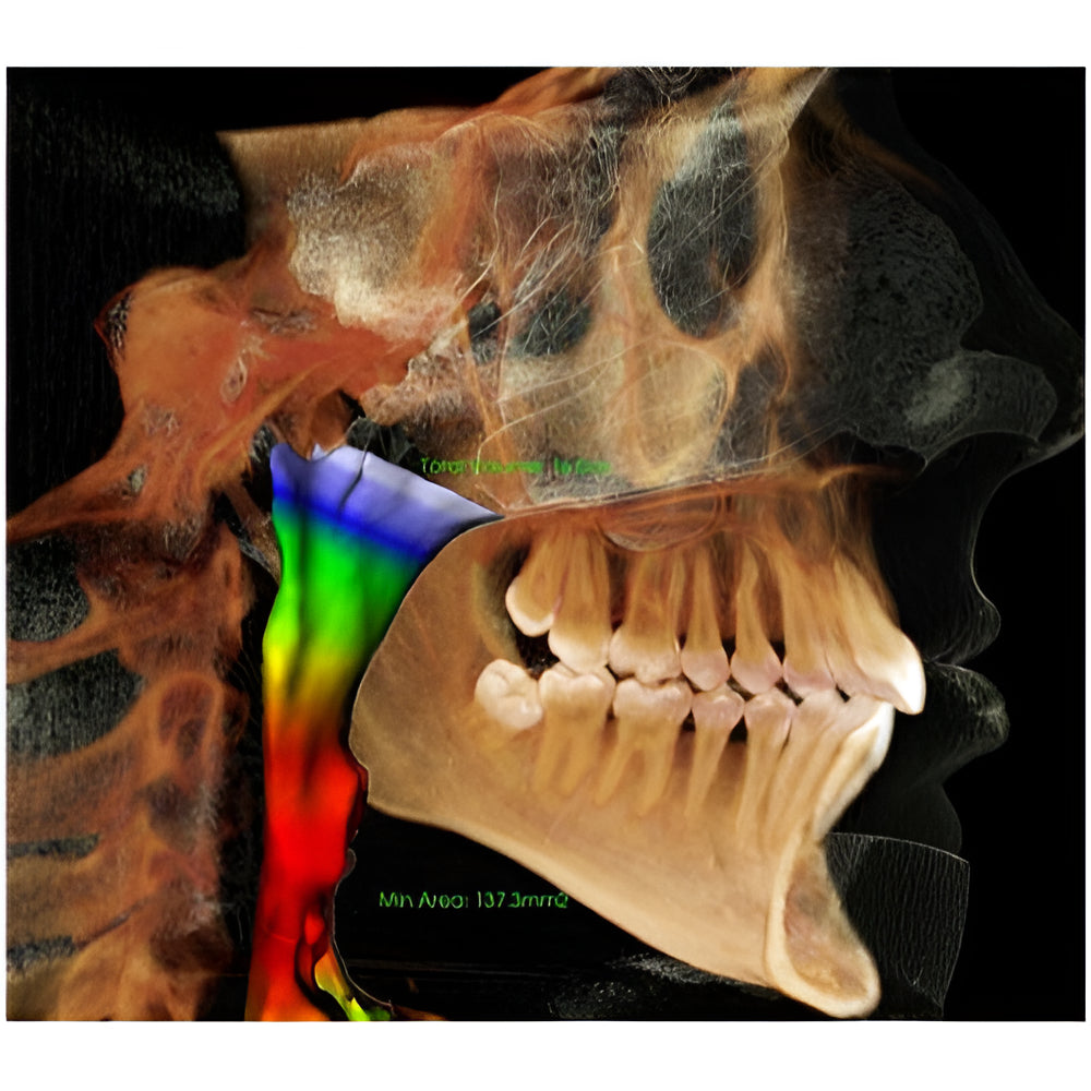 i-CAT FLX V17 Pan + CBCT (23x17 FOV)