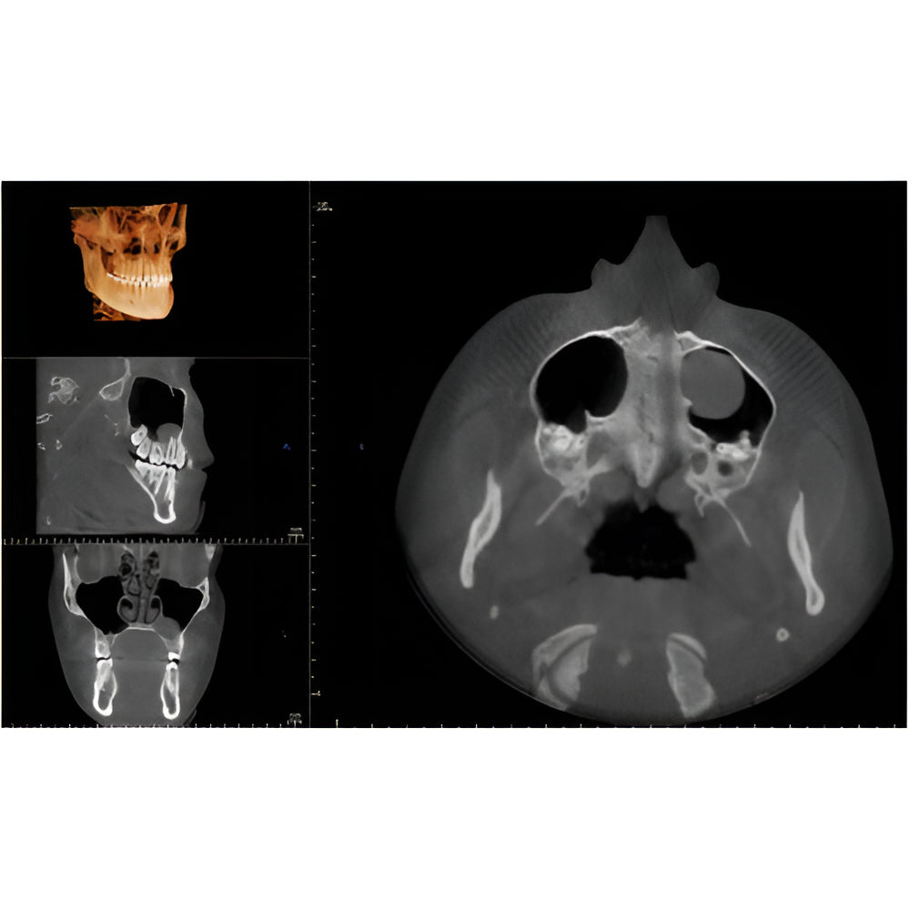 i-CAT FLX V17 Pan + CBCT (23x17 FOV)