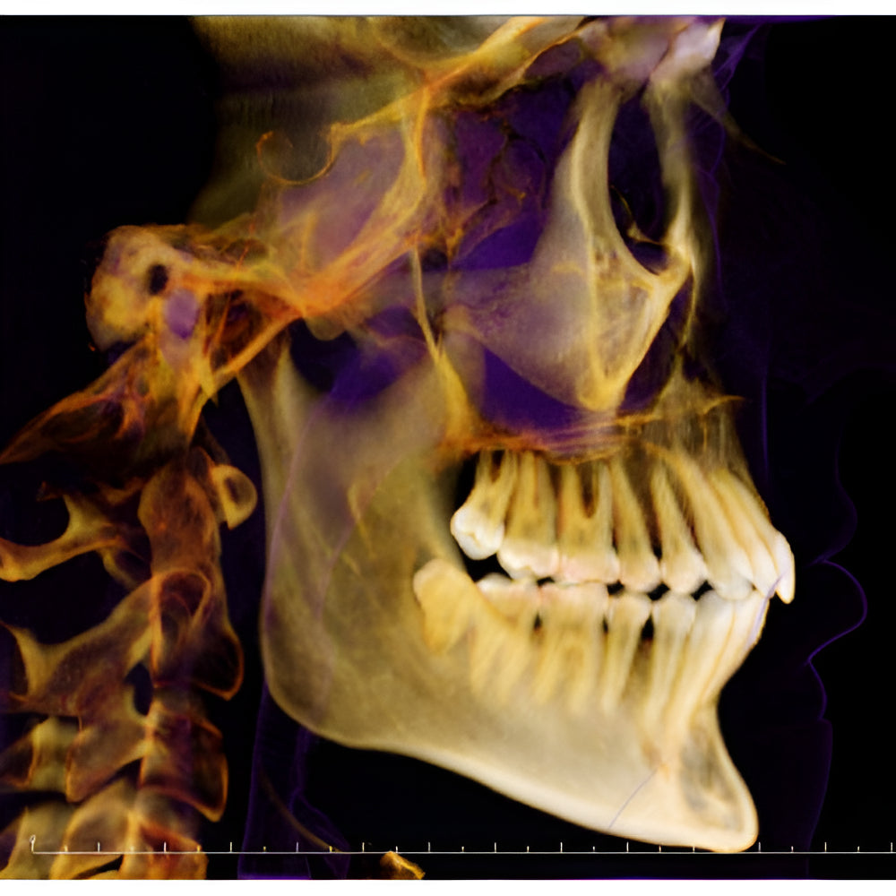 i-CAT FLX V17 Pan + CBCT (23x17 FOV)