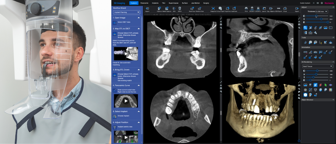 Find the Right FOV for Your Practice