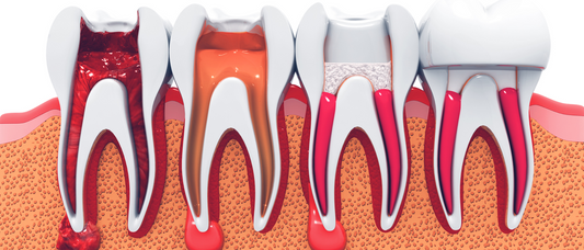 How CBCT Transforms Endodontic Outcomes