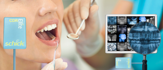 Schick Intraoral Sensors: A Legacy of Excellence, Now Available at Global Imaging