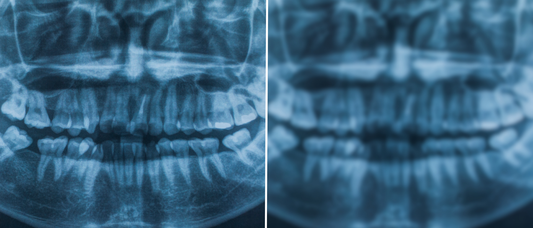 Image Quality in Dental CBCT Imaging