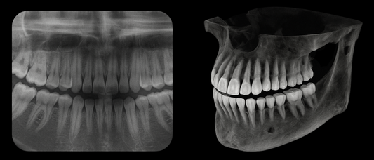 Upgrade to CBCT and Maximize the Value of Your Old X-Ray