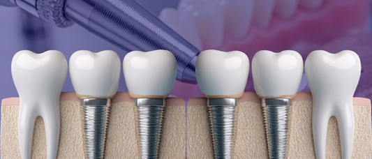 Why CBCT Scans Are Essential for Safe and Predictable Implant Planning