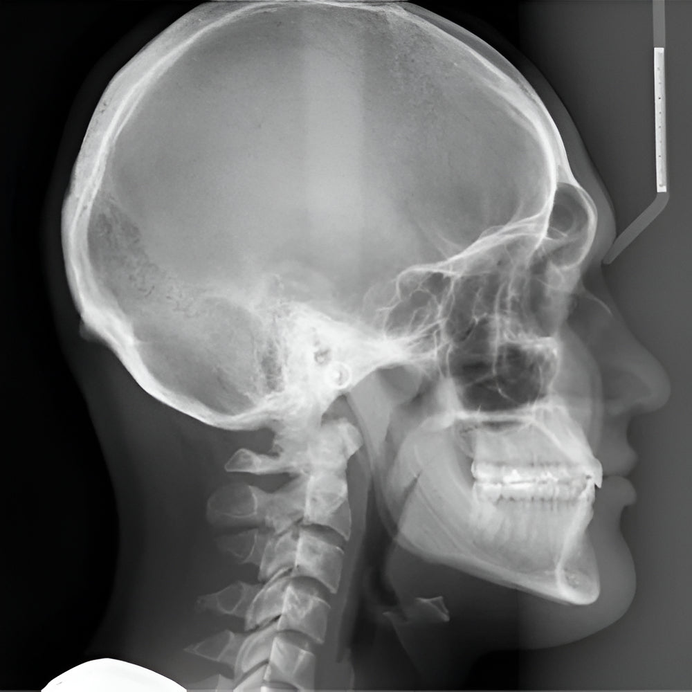 Cephalometric