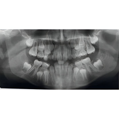 Acteon XMind Trium Pan + CBCT (11x8 FOV)