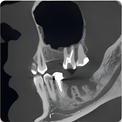 Acteon XMind Trium Pan + CBCT (11x8 FOV)