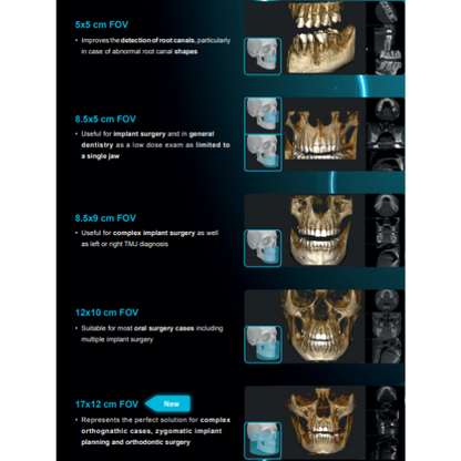 Acteon XMind Optima Pan + CBCT (12x10 FOV) with PC, Software, Installation, Shipping and Warranty