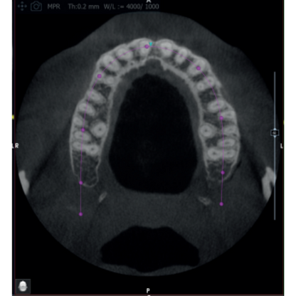 Acteon XMind Optima Pan + CBCT (12x10 FOV) with PC, Software, Installation, Shipping and Warranty
