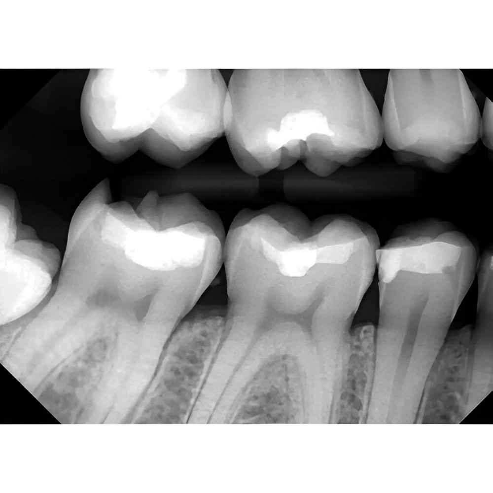 DentiMax Dream Digital Intra-Oral Sensor with Warranty