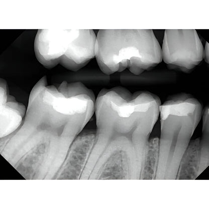 DentiMax Dream Digital Intra-Oral Sensor with Warranty