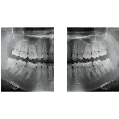 Gendex GXDP-700 Pan + CBCT (8x6 FOV) with PC, Software, Installation, Shipping and Warranty