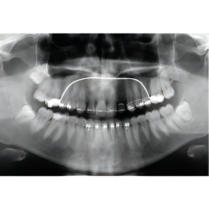 Gendex GXDP-700 Pan + CBCT (8x6 FOV) with PC, Software, Installation, Shipping and Warranty