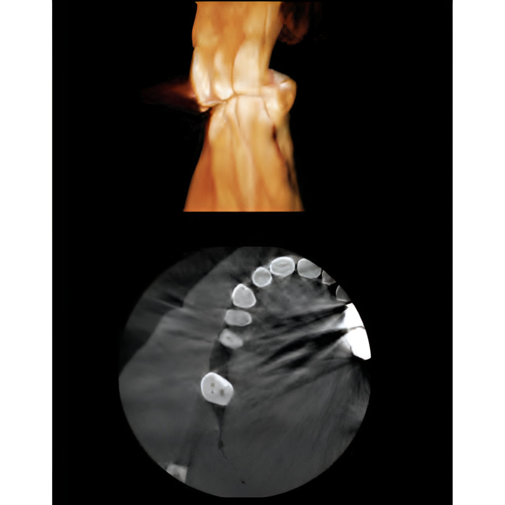 Gendex GXDP-700 Pan + CBCT (8x6 FOV) with PC, Software, Installation, Shipping and Warranty