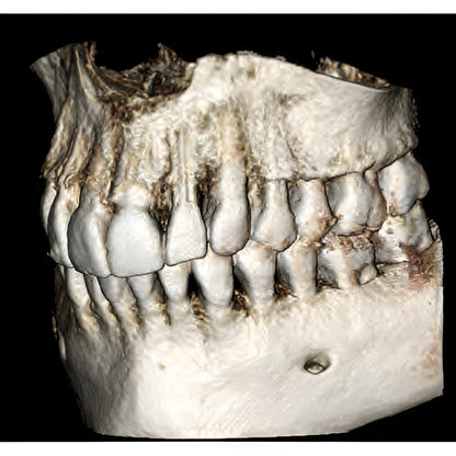 Gendex GXDP-700 Pan + CBCT (8x6 FOV) with PC, Software, Installation, Shipping and Warranty