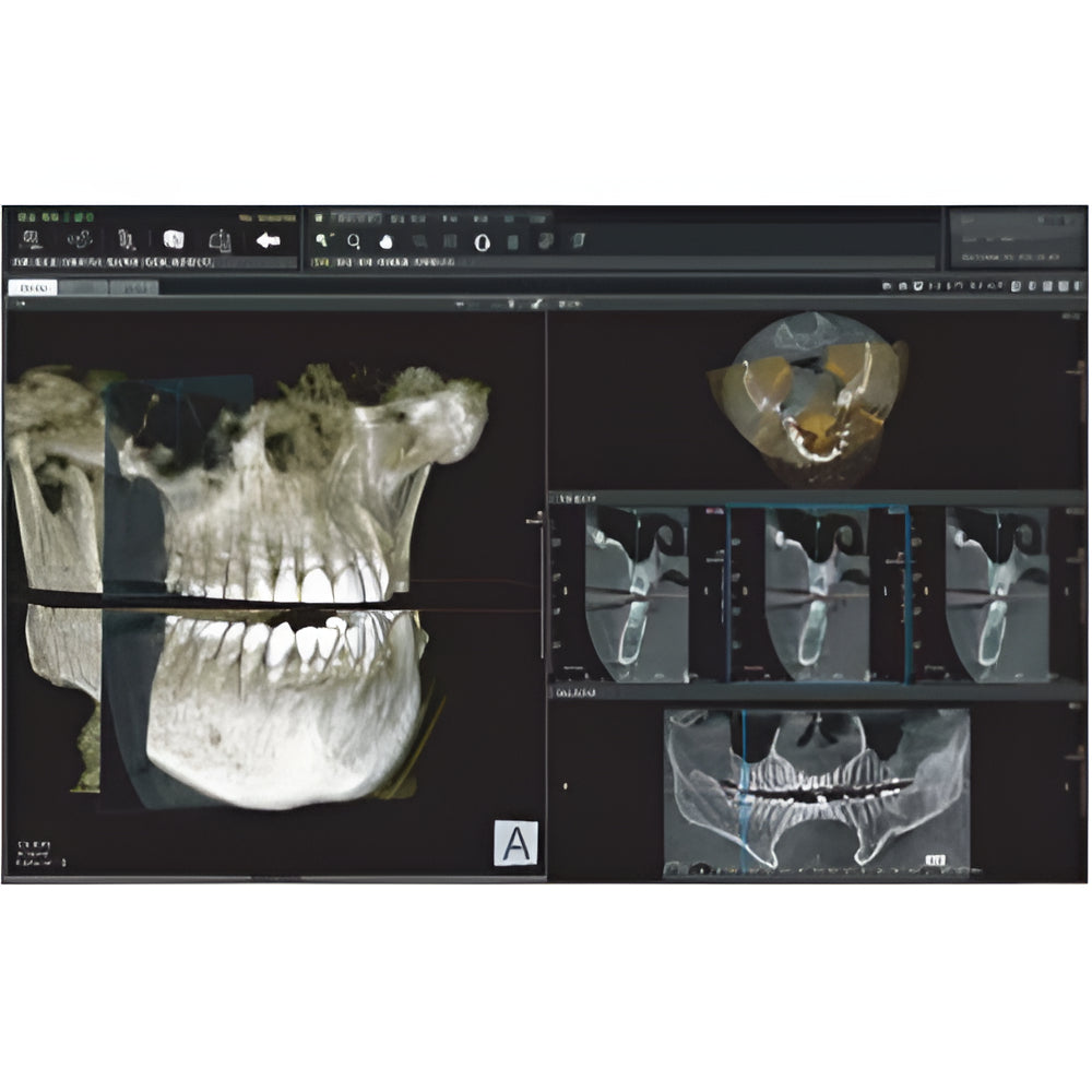 Genoray Papaya Plus Pan + CBCT (FOV 14x14) with PC, Software, Installation, Shipping and Warranty (Copy)