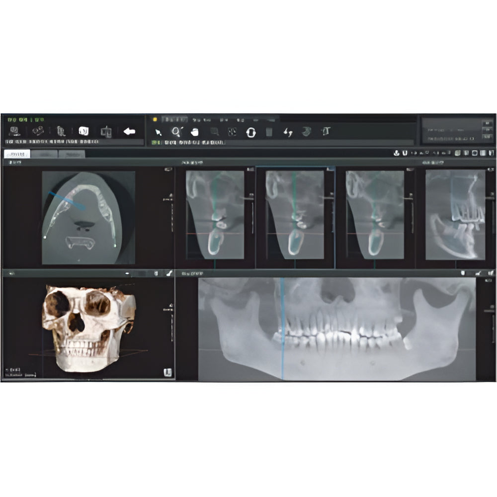 Genoray Papaya Plus Pan + CBCT (FOV 14x14) with PC, Software, Installation, Shipping and Warranty (Copy)