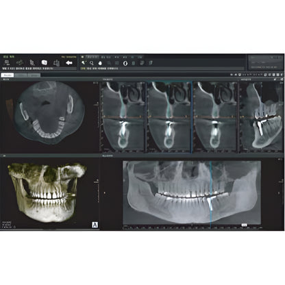 Genoray Papaya Plus Pan + CBCT (FOV 14x14) with PC, Software, Installation, Shipping and Warranty (Copy)