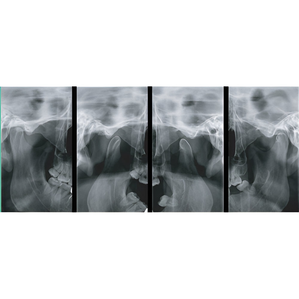 2022 Genoray Papaya Slim Pan