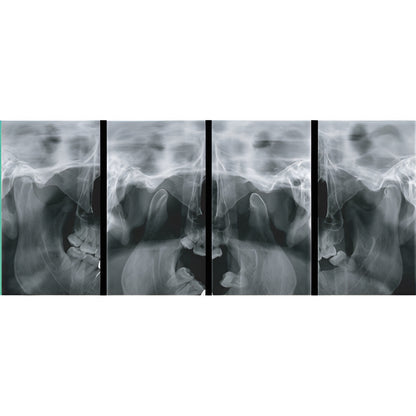 2022 Genoray Papaya Slim Pan