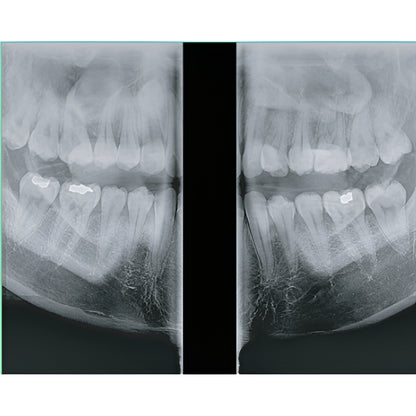 2022 Genoray Papaya Slim Pan