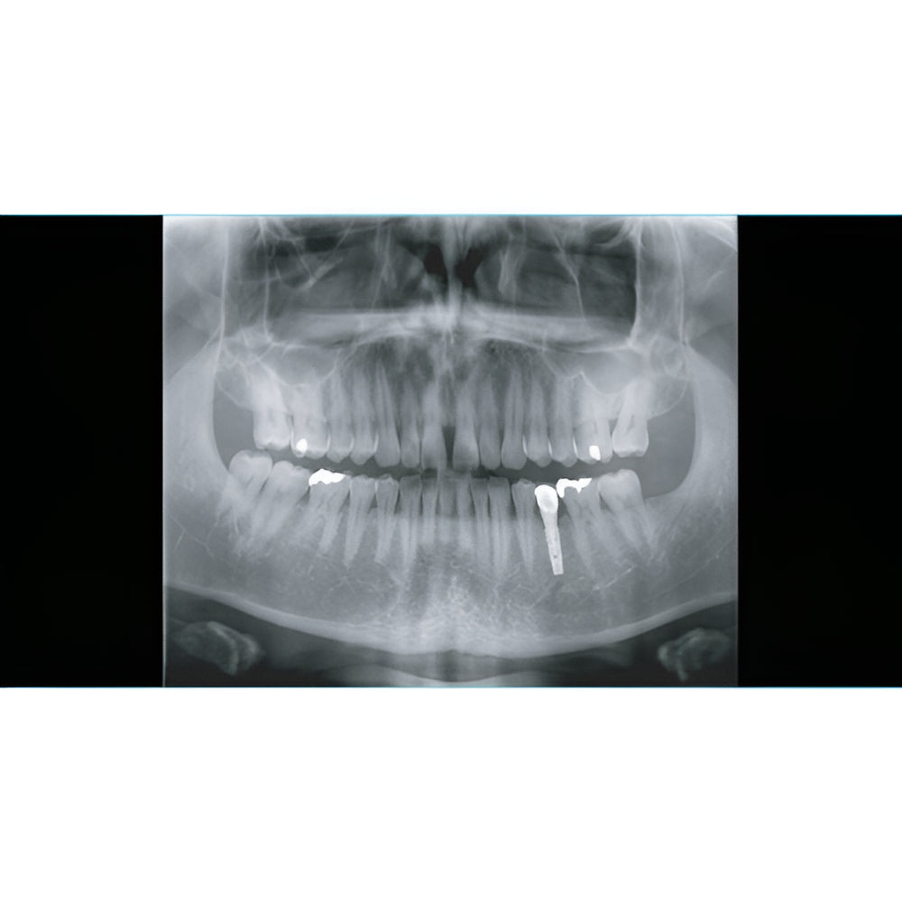 2022 Genoray Papaya Slim Pan