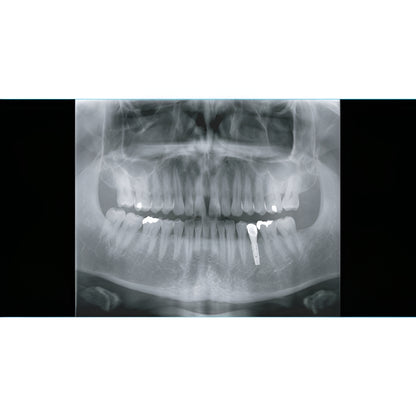 2022 Genoray Papaya Slim Pan