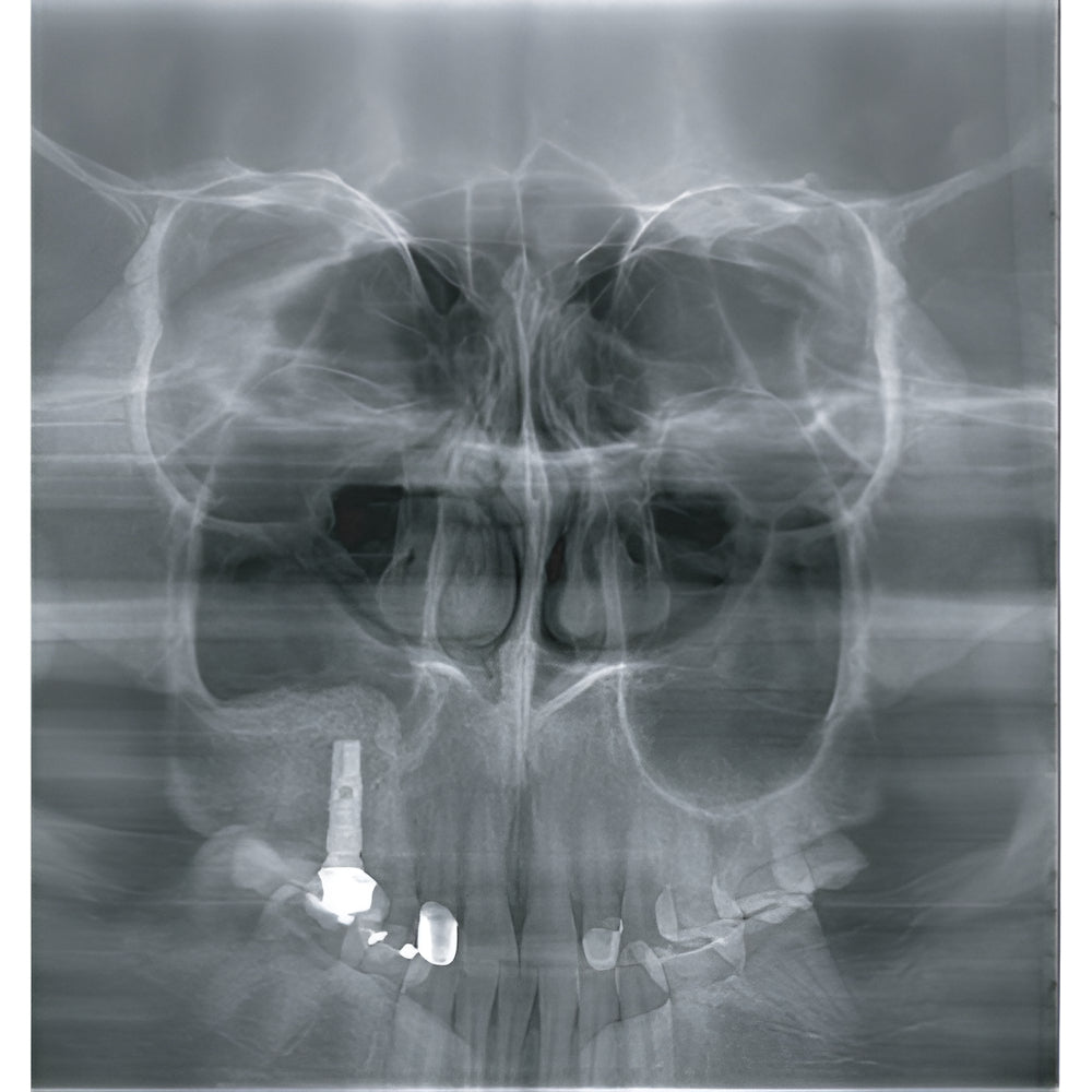 2022 Genoray Papaya Slim Pan