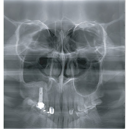 2022 Genoray Papaya Slim Pan