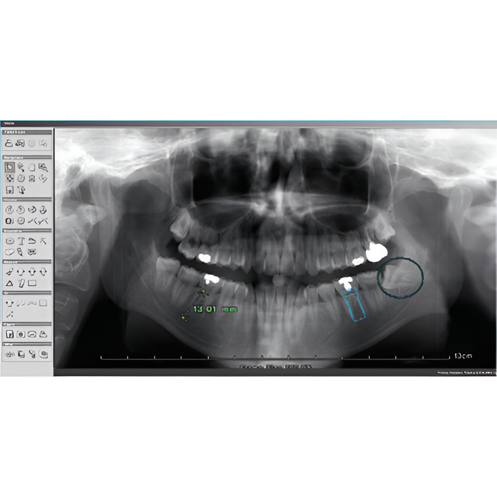 2022 Genoray Papaya Slim Pan