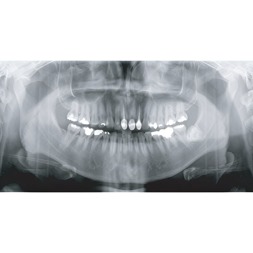 2022 Genoray Papaya Slim Pan