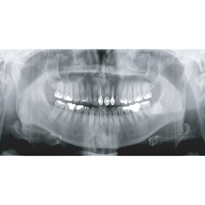 2022 Genoray Papaya Slim Pan