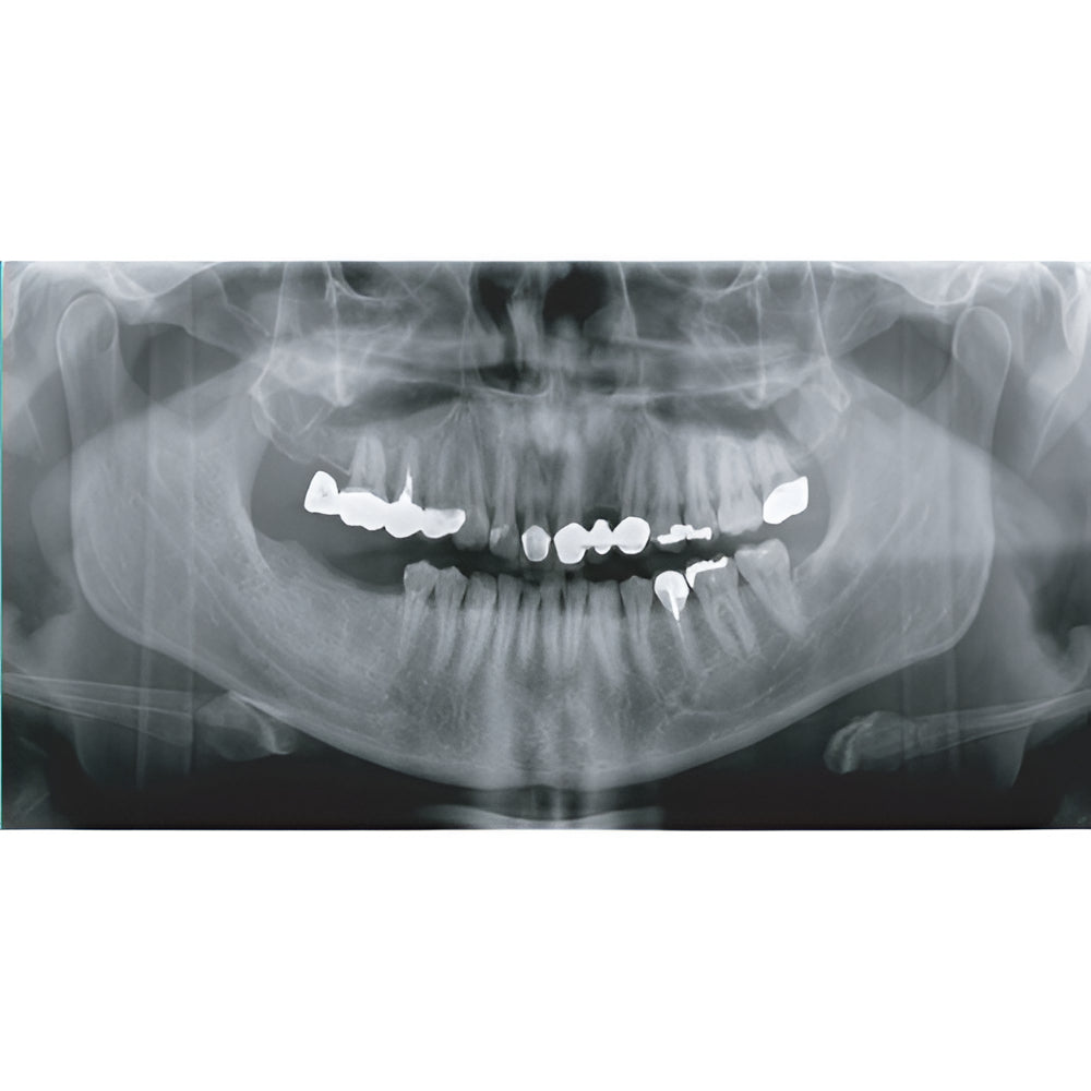 2022 Genoray Papaya Slim Pan