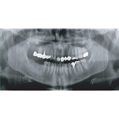 2022 Genoray Papaya Slim Pan