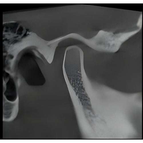 Instrumentarium OP300 Pan + CBCT (6x8 FOV) with PC, Software, Installation, Shipping and Warranty