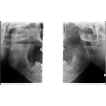 Instrumentarium OP300 Pan + CBCT (6x8 FOV) with PC, Software, Installation, Shipping and Warranty