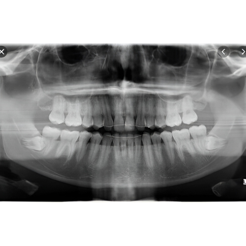 Instrumentarium OP300 Pan + CBCT (6x8 FOV) with PC, Software, Installation, Shipping and Warranty