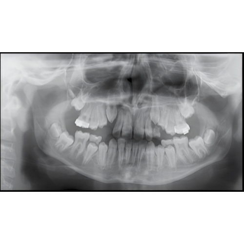 Instrumentarium OP300 Pan + CBCT (6x8 FOV) with PC, Software, Installation, Shipping and Warranty