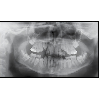 Instrumentarium OP300 Pan + CBCT (6x8 FOV) with PC, Software, Installation, Shipping and Warranty