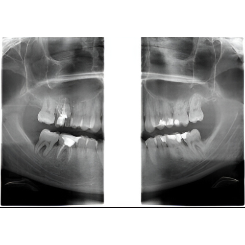 Instrumentarium OP300 Pan + CBCT (6x8 FOV) with PC, Software, Installation, Shipping and Warranty