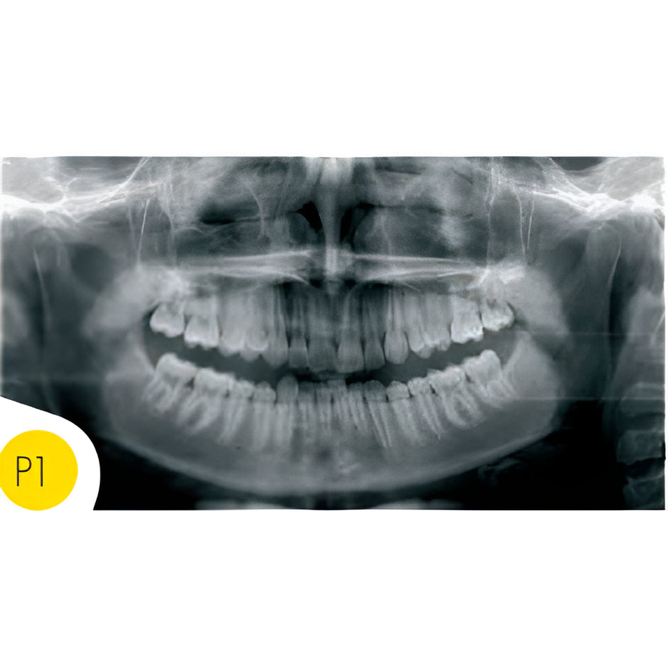Instrumentarium – Global Imaging USA