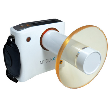 Chairside Imaging Bundle - MobileX Handheld Xray Generator and 2 x Schick CDR Elite Sensors
